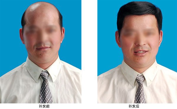 真的有生發(fā)小方法嗎？