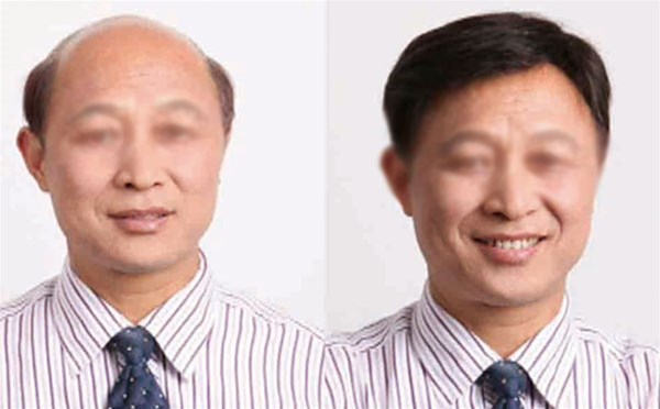 假發(fā)很亂要怎么打理 ？放好位置很重要