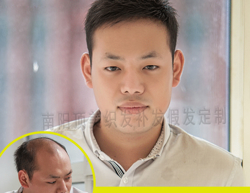織發(fā)補(bǔ)發(fā)