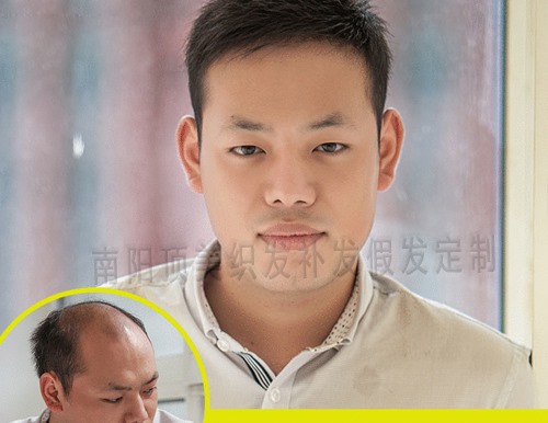 織發(fā)補(bǔ)發(fā)